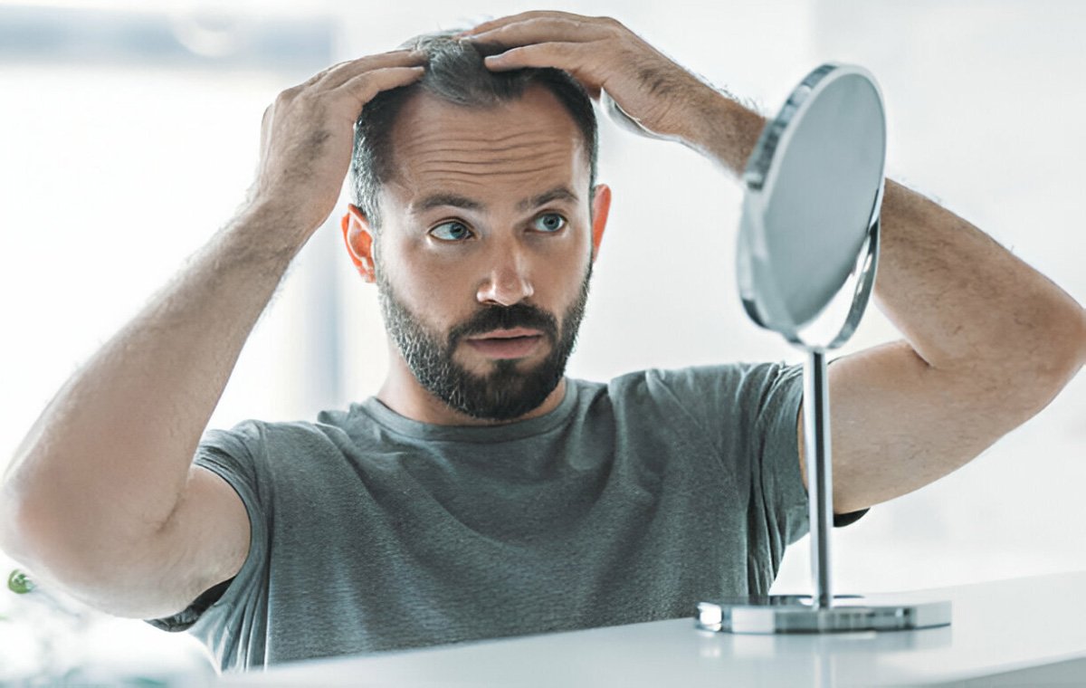 Hair Loss in Men: Causes, Prevention, and Effective Treatments